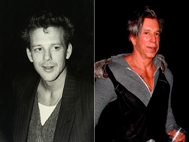 Mickey Rourke - antes e depois (Foto: Getty Images | AKM)