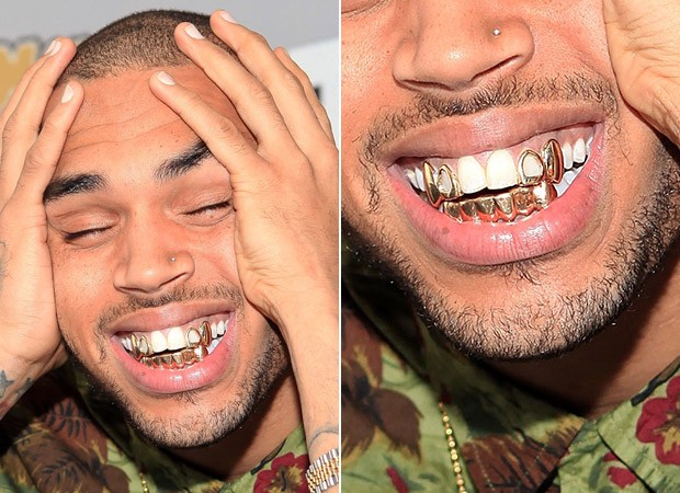 Chris Brown  - Grillz (Foto: Agência Getty Images )