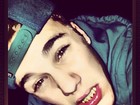 Justin Bieber posa com acessório exótico nos dentes