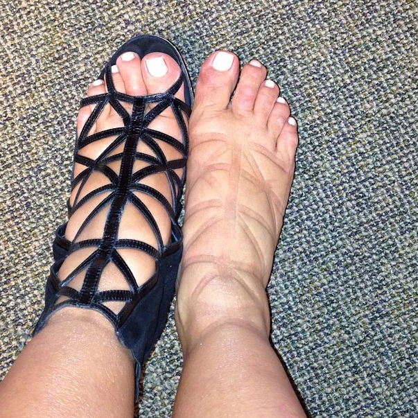 Kim Kardashian mostra os pés inchados (Foto: Reprodução/Instagram)