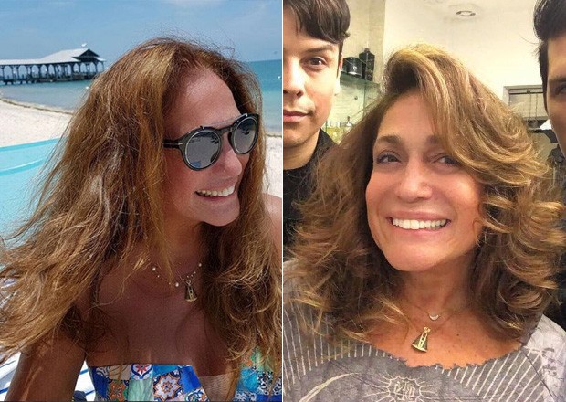 Antes e depois de Susana Vieira  (Foto: Instagram / Reprodução)