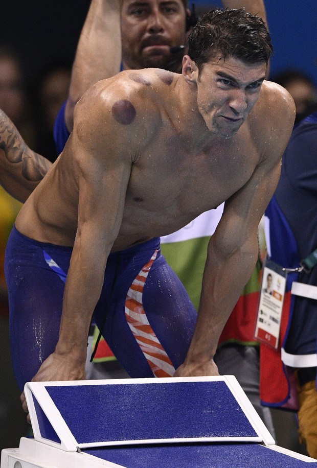 Marcas nas costas de Michael Phelps chamaram atenção na Rio 2016 (Foto: Martin BUREAU / AFP)