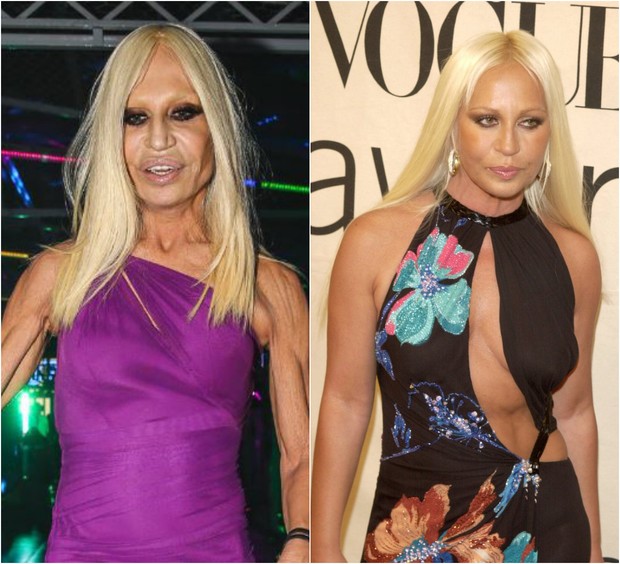 Donatella Versace.  Celebridades, Donatella versace, Celebridades antes e  depois