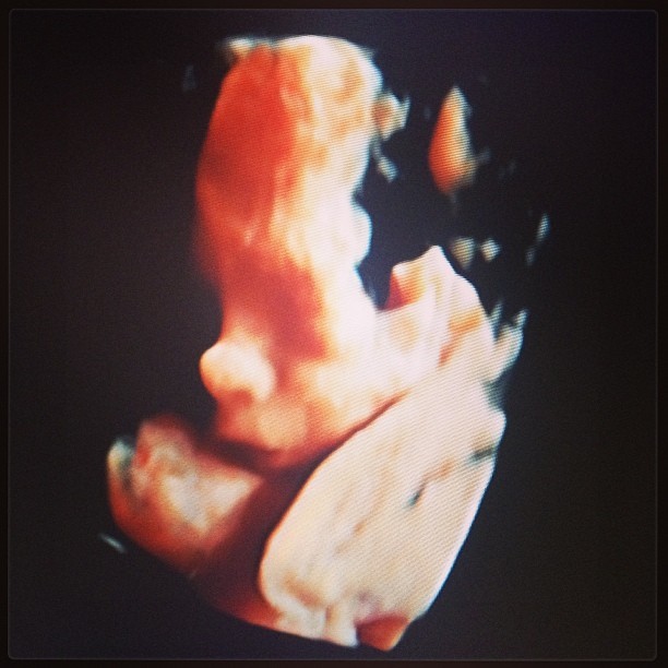 Ana Hickmann mostra ultrassom do filho (Foto: Instagram)