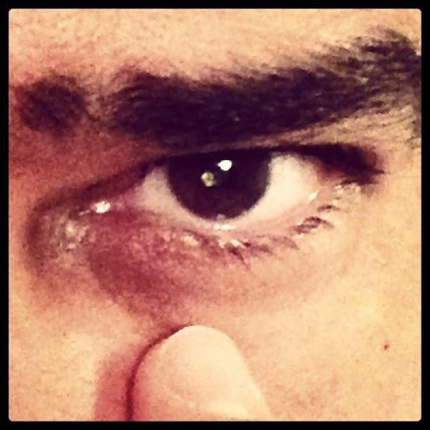 Willian Bonner posta foto do olho operado (Foto: Instagram / Reprodução)