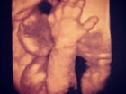 Juliana Paes posta ultrassom de filho e pergunta: 'Adivinhem quem é?'
