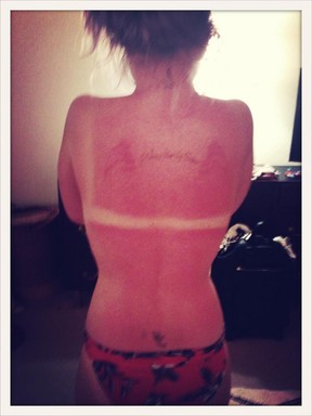 Kelly Osbourne exibe marca de sol (Foto: Twitter/ Reprodução)