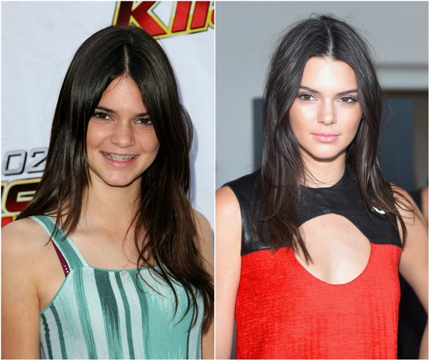 Kendall Jenner aos 14 anos e aos 20 anos (Foto: Getty Images/AFP)