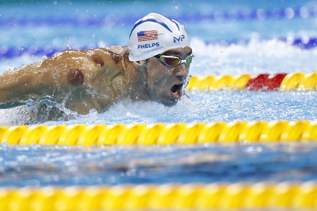 Marcas nas costas de Michael Phelps chamaram atenção na Rio 2016 (Foto: Odd Andersen / AFP)