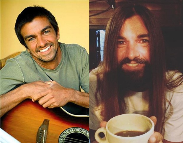 Armandinho: antes e depois (Foto: Reprodução/Instagram)