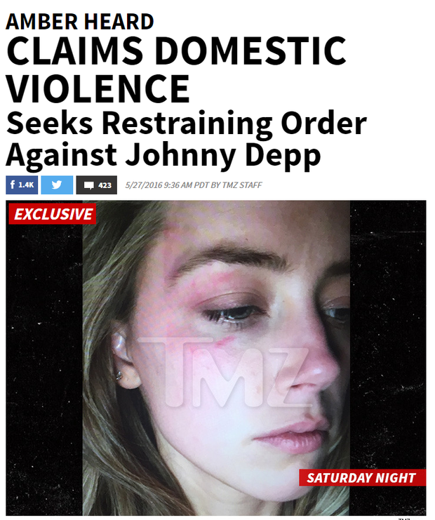 Amber Heard mostra rosto após suposta agressão (Foto: Reprodução/TMZ)
