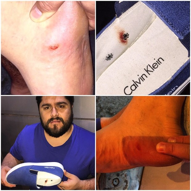 César Menotti mostra pé machucado após usar tênis de grife (Foto: Reprodução/Instagram)