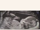 Karina Bacchi, grávida, mostra ultrassom: 'Presente enviado por Deus'