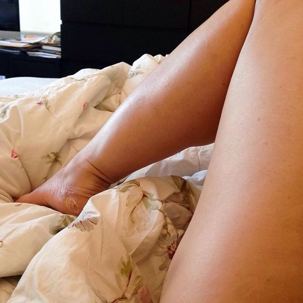 Pernas de Nana Gouvêa (Foto: Instagram / Reprodução)