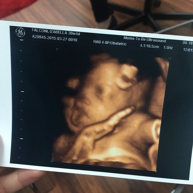  Ultrassom do bebê de Bella Falconi (Foto: Instagram / Reprodução)