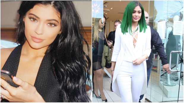 Kylie Jenner antes e depois (Foto: Reprodução/Instagram/X17)