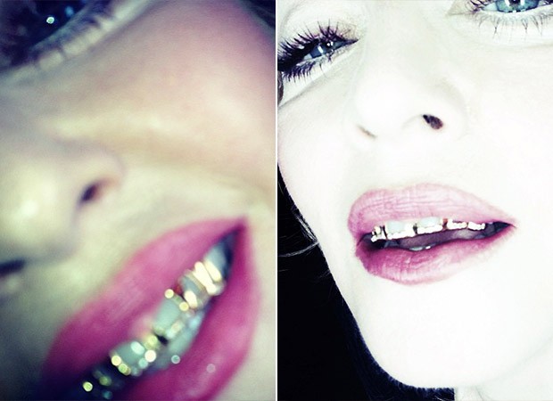 Madonna - Grillz (Foto: Instagram / Reprodução)
