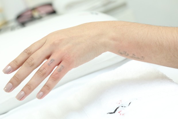 Andressa Urach removendo tatuagem (Foto: Thais Aline/ Agência Fio Condutor)