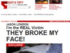 Site divulga imagens de Jason London após agressão
