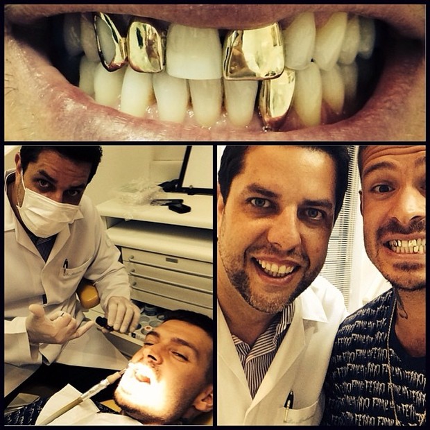Mateus Verdelho coloca dentes de ouro (Foto: Instagram / Reprodução)