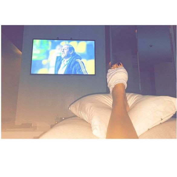 Fernanda Souza mostra pé machucado (Foto: Instagram)