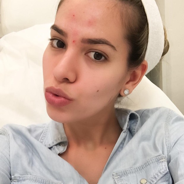 Adriana Sant&#39;Anna coloca botox pela primeira vez: &#39;Muito feliz&#39; (Foto: Reprodução/Instagram)
