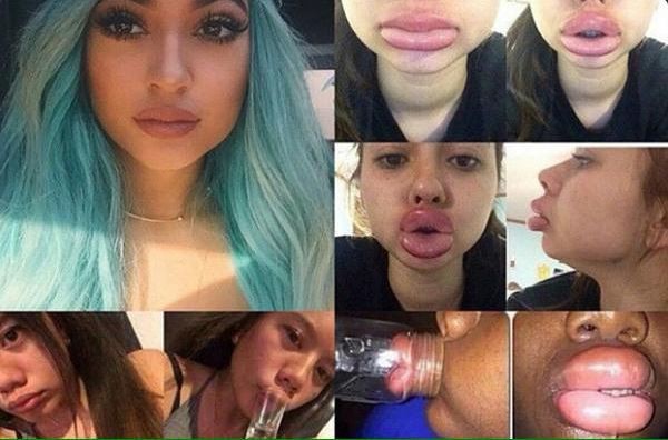 Kylie Jenner faz alerta após polêmica para aumentar volume dos lábios em rede social (Foto: Reprodução do Twitter)