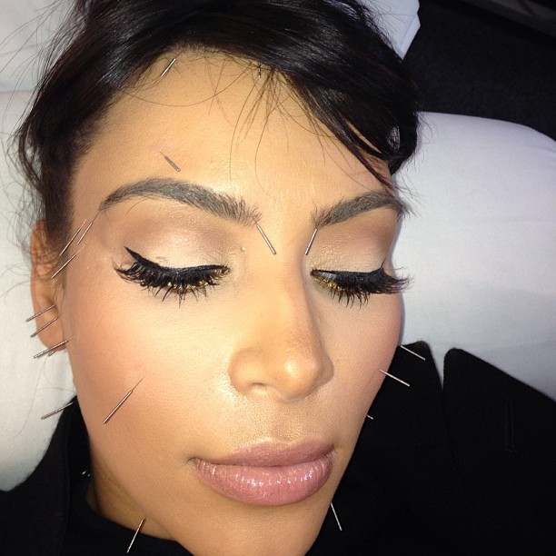 Kim Kardashian faz acupuntura e posta foto para fãs (Foto: Instagram)