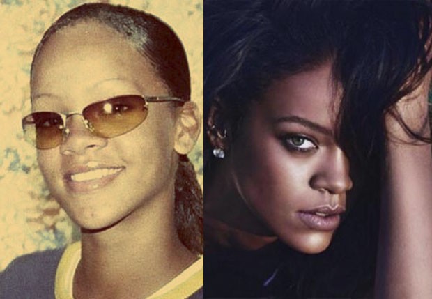 Rihanna antes e depois (Foto: Reprodução/Instagram)