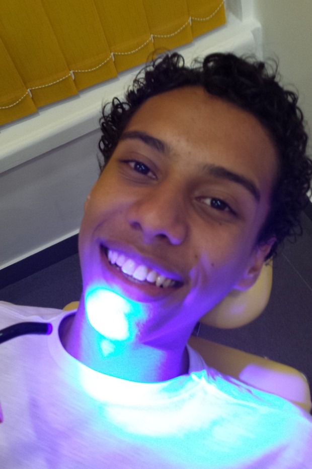 Cadu Paschoal faz clareamento dental (Foto: Divulgação)