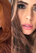 Amanda Gontijo faz preenchimento labial: veja o antes e o depois