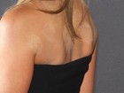 De look curtinho, Jennifer Aniston exibe manchas estranhas nas costas