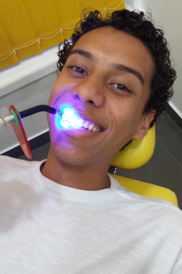 Cadu Paschoal faz clareamento dental (Foto: Divulgação)