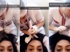 Amanda Djehdian mostra tratamento para queda de cabelo: 'Doze agulhas'