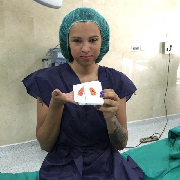 Ex-BBB Ariadna após operação em uma clínica em Málaga, na Espanha (Foto: Instagram/ Reprodução)