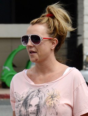 Britney Spears com o queixo machucado em Los Angeles, nos Estados Unidos (Foto: Splash News/ Agência)
