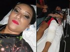Porta-bandeira Jéssica Ferreira após tombo na Sapucaí: 'Remédios para dor'