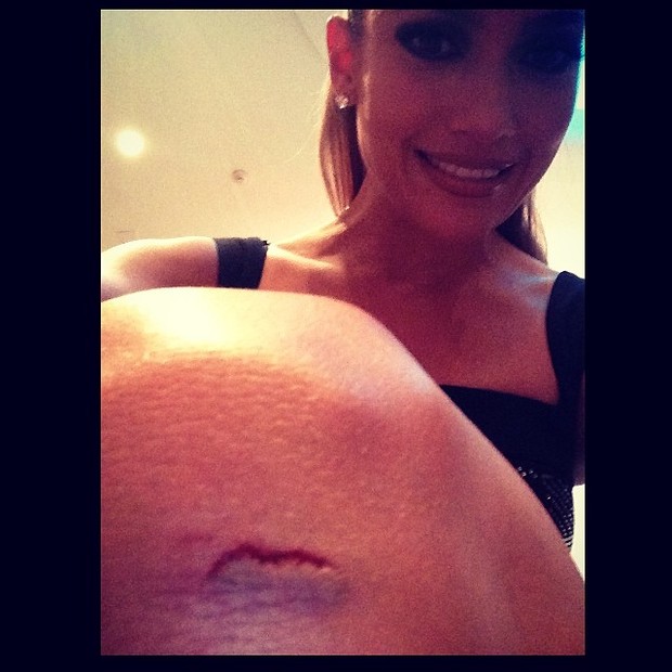 Jennifer Lopez mostra corte no joelho (Foto: Reprodução/ Instagram)