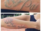 Bárbara Evans posta foto de tatuagem que está sendo removida