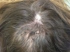 Mortágua mostra falhas no cabelo após usar química e levar tombo