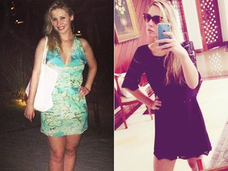 Ana Carolina Madeira - antes e depois (Foto: Reprodução/Instagram)
