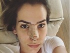 Adriana Sant'Anna mostra foto com curativo no nariz: 'Recuperando'