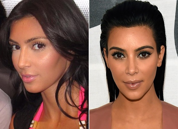 Kim Kardashian - Antes e Depois (Foto: Instagram / Reprodução - Rick Diamond/ Getty Images/ AFP)