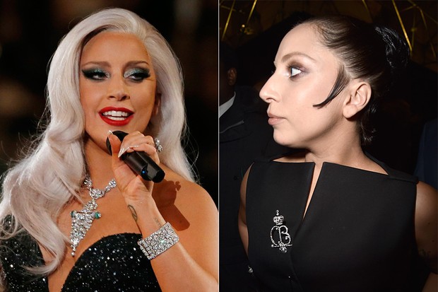 Lady Gaga - Antes e Depois (Foto: Agência Getty Images - Agência Reuters)