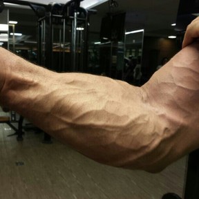 Detalhe do braço do ex-BBB Kadu após malhação (Foto: Instagram/ Reprodução)