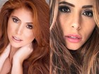 Amanda Gontijo faz preenchimento labial: veja o antes e o depois