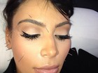 Kim Kardashian faz acupuntura e posta foto com rosto cheio de agulhas