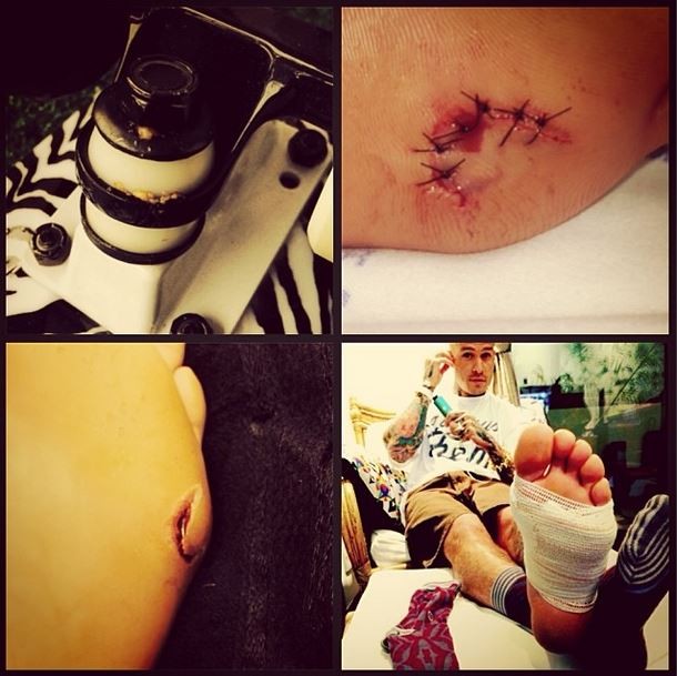 Mateus Verdelho se machuca após fazer flip no fish skateboards (Foto: Instagram / Reprodução)