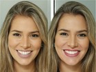 Antes e depois: Adriana Sant'Anna recorre à micropigmentação na boca
