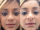 Cariúcha faz cirurgia estética e empina o nariz: 'Estou cada dia mais linda'  